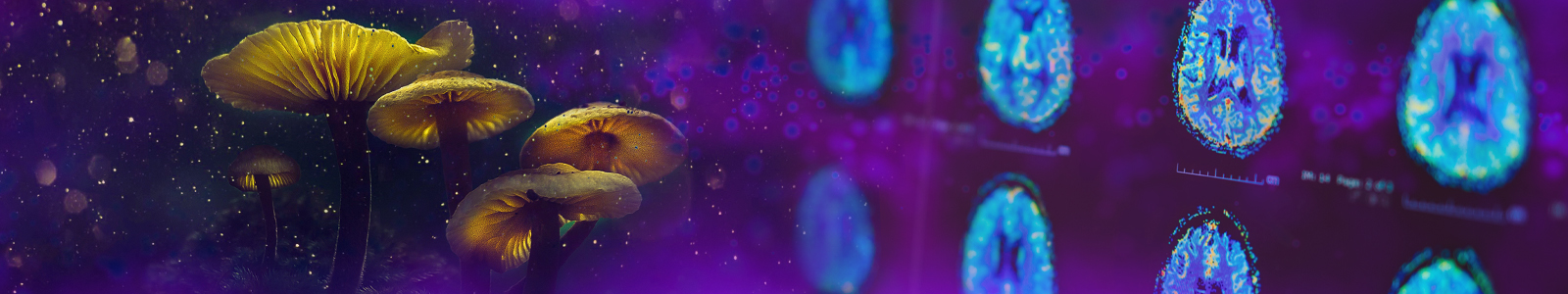 Banner image of glowing mushrooms and MRI brain scans